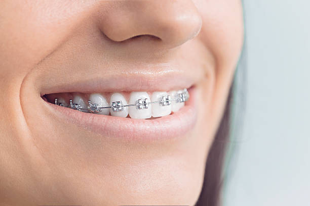 Best Dental Inlays and Onlays  in Rio Verde, AZ
